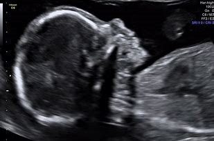 Blog verloskundige ervaringen